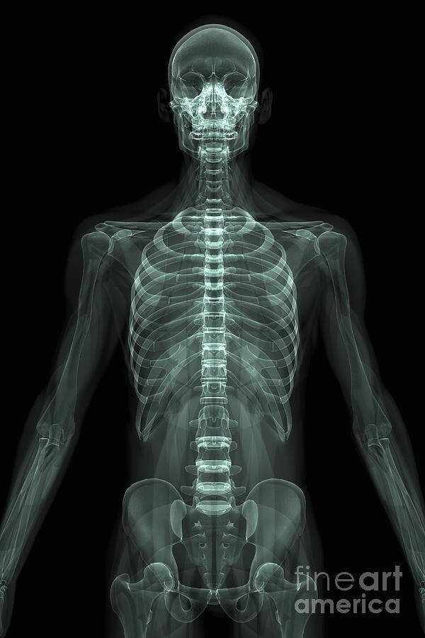 X-Ray Image